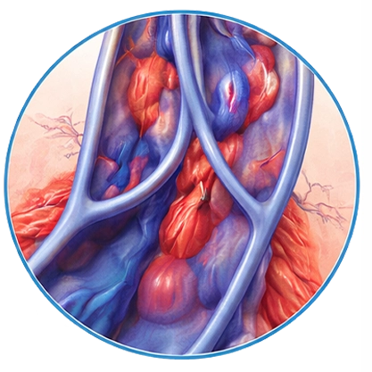 Advanced Venous Disease