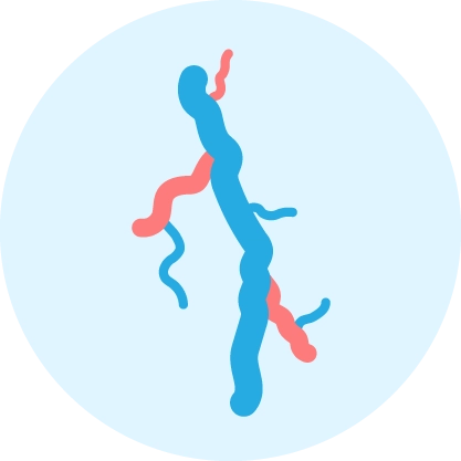 Varicose Veins