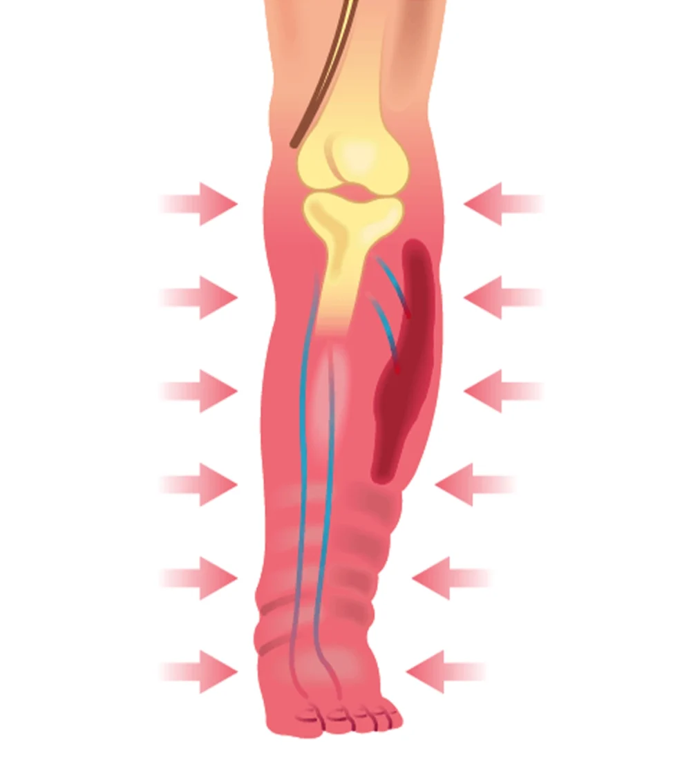 Advanced Venous Disease Alabama